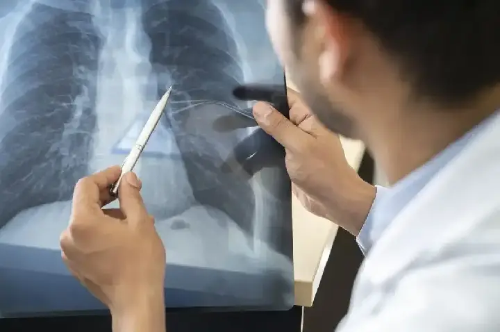 Tabagismo é maior entre jovens de 16 a 24 anos, alerta pesquisa